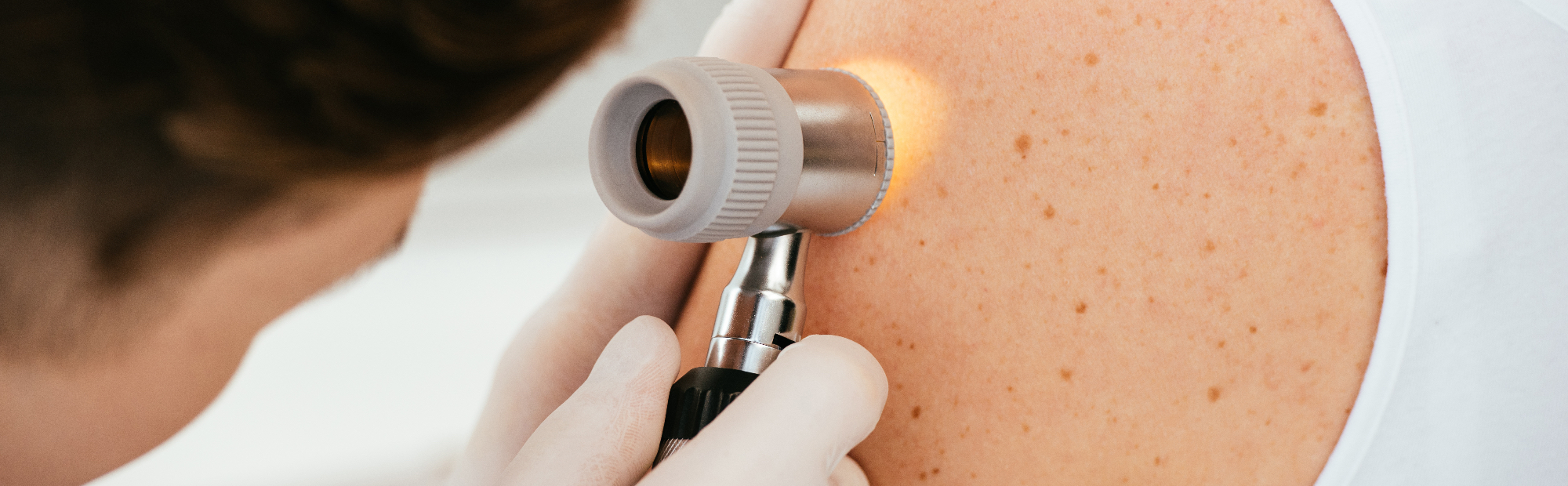 Dermatologija Ljubljana - Hitra in strokovna storitev.